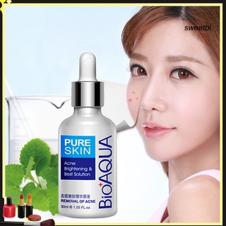 Tinh Chất Bioaqua Ngừa Mụn Kiểm Soát Dầu Dưỡng Ẩm Hiệu Quả 30ml
