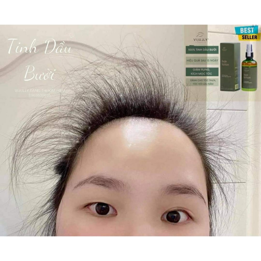 COMBO DẦU GỘI BƯỞI VIJULLY [CHÍNH HÃNG] (Gội+xả+tinh dầu) | BigBuy360 - bigbuy360.vn