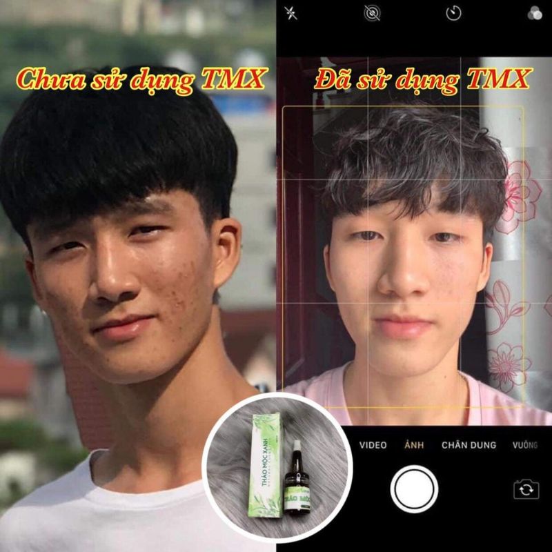 [ CHÍNH HÃNG]SERUM THẢO MỘC XANH | BigBuy360 - bigbuy360.vn