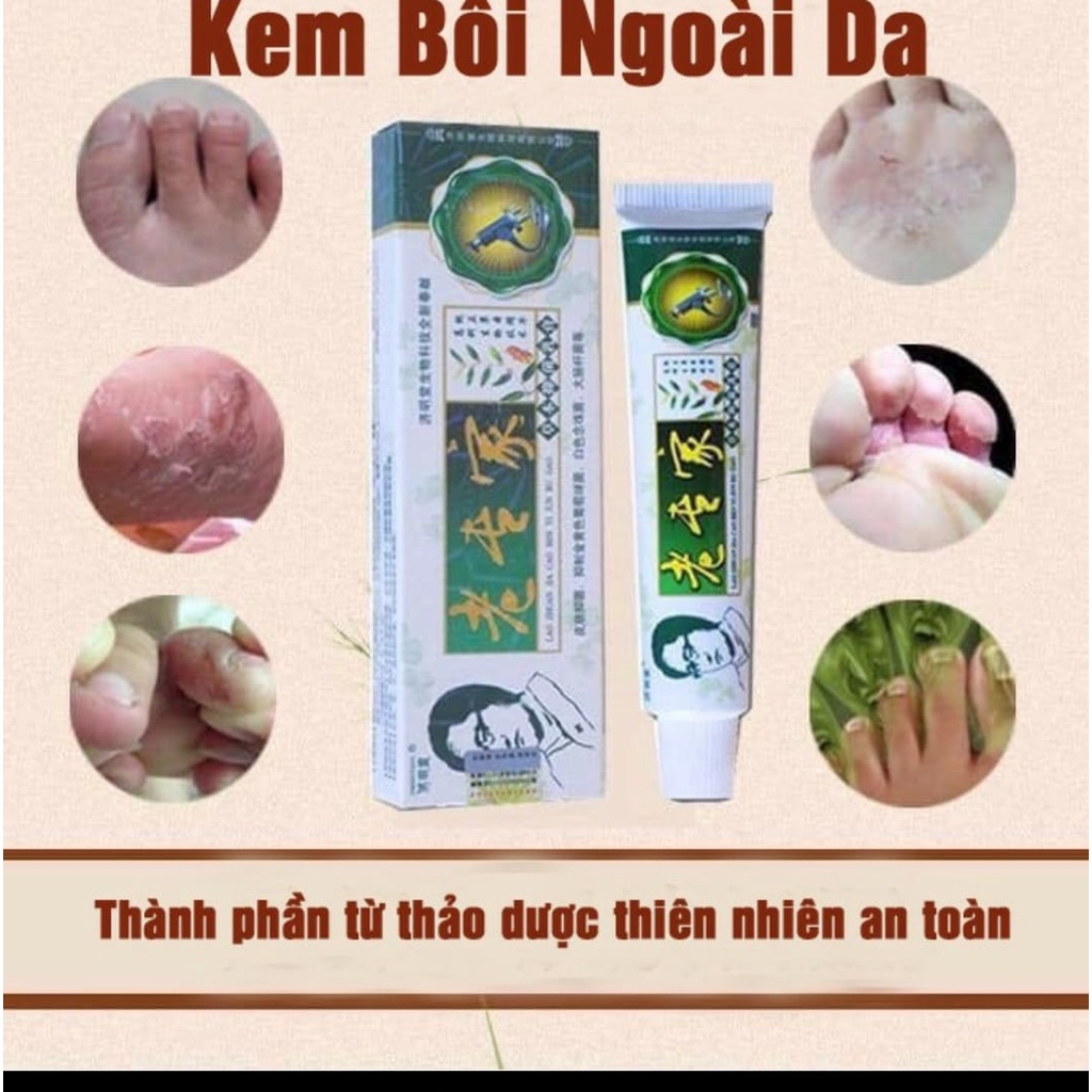 KEM NẤM NGỨA, VẢY NẾN Á SỪNG, MUỖI ĐỐT...