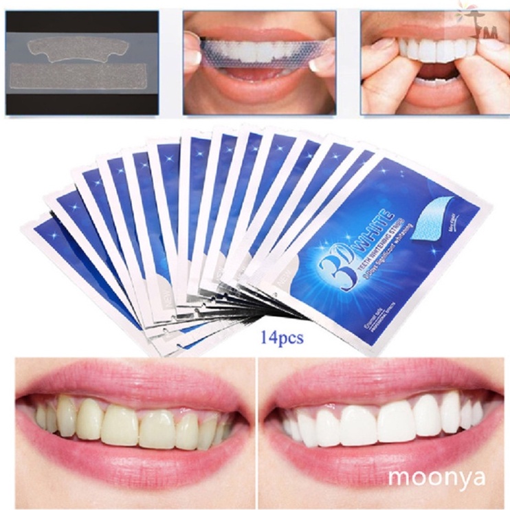 Miếng dán làm trắng răng 3D chất lượng cao tiện dụng