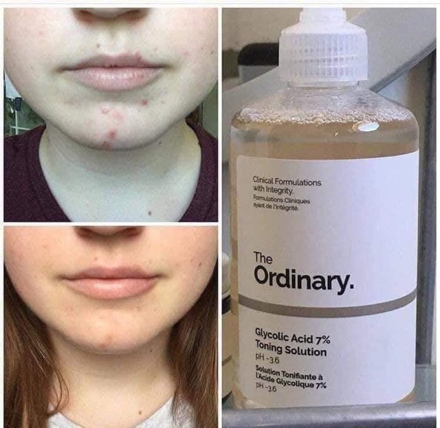 TONER THE ORDINARY GLYCOLIC ACID 7% TONING SOLUTION