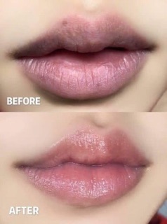 KHỬ THÂM LÀM HỒNG MÔI TREECHADA LIP MASK