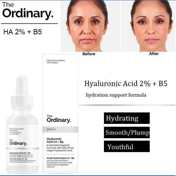 Serum The Ordinary Hyaluronic Acid 2%+B5 30ml cấp ẩm phục hồi dành cho da khô, thừa dầu thiếu nước và thâm sạm nhạy cảm