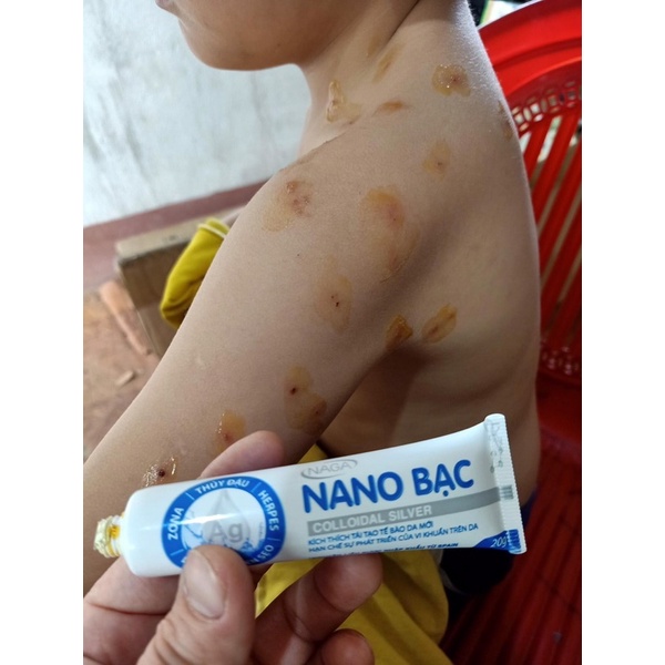 Gel bôi Naga nano bạc