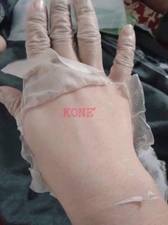 Nước lột kone