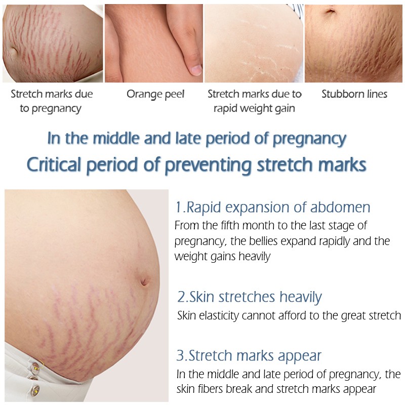 Kem Hỗ Trợ Giảm Sẹo Sau Khi Sinh VIBRANT GLAMOUR Làm Trắng Và Săn Chắc Mịn Mượt Chống Lão Hóa 30g | BigBuy360 - bigbuy360.vn