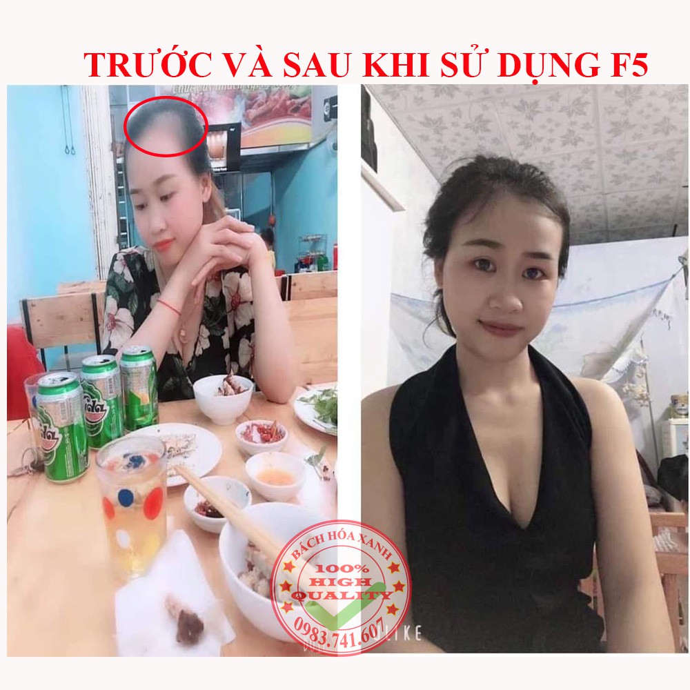 Dầu gội gội thảo dược ngăn rụng tóc F5, giảm rụng tóc, kích thích mọc tóc nhanh, an toàn, không gây kích ứng da đầu