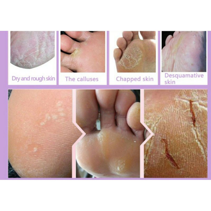 Ủ lột chân hương oải hương mới | BigBuy360 - bigbuy360.vn