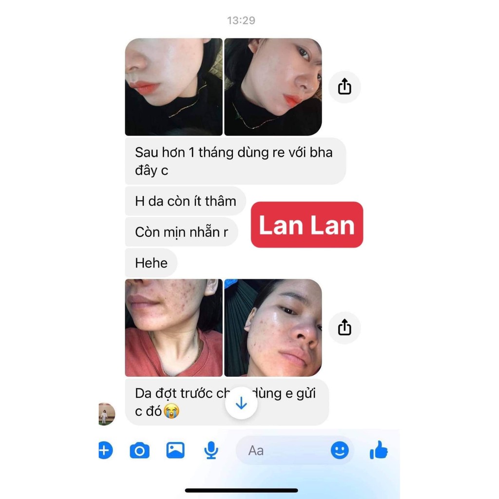 Kem Dưỡng Ban Đêm - Chống Lão Hoá