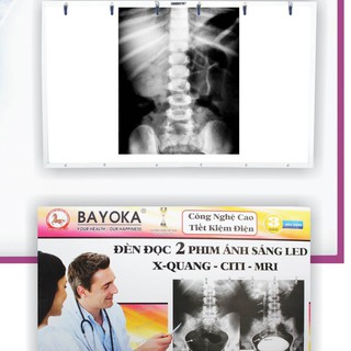 🔥free ship🔥 đèn đọc phim x-quang ct mri ánh sáng led bayoka