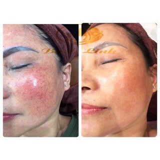 Bạch Linh 3_Bách Y Sâm 03 Chuyên Nám (Mẫu Mới) .