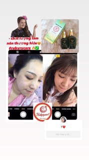 BAY MỤN RubyCare