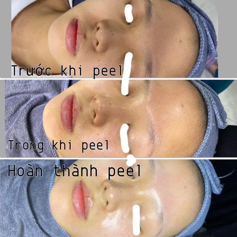 Thay Da Sinh Học Inno LIGHTENING 15g