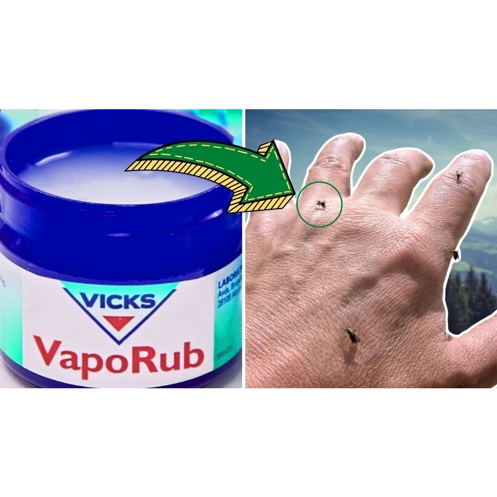 [Giảm ho] Dầu bôi ấm ngực Vicks VapoRub hũ 50g của Pháp