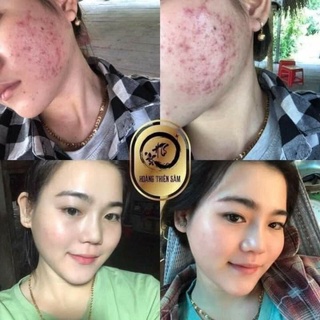 Bột Rửa Mặt Thảo Dược Hoàng Thiên Sâm 100g