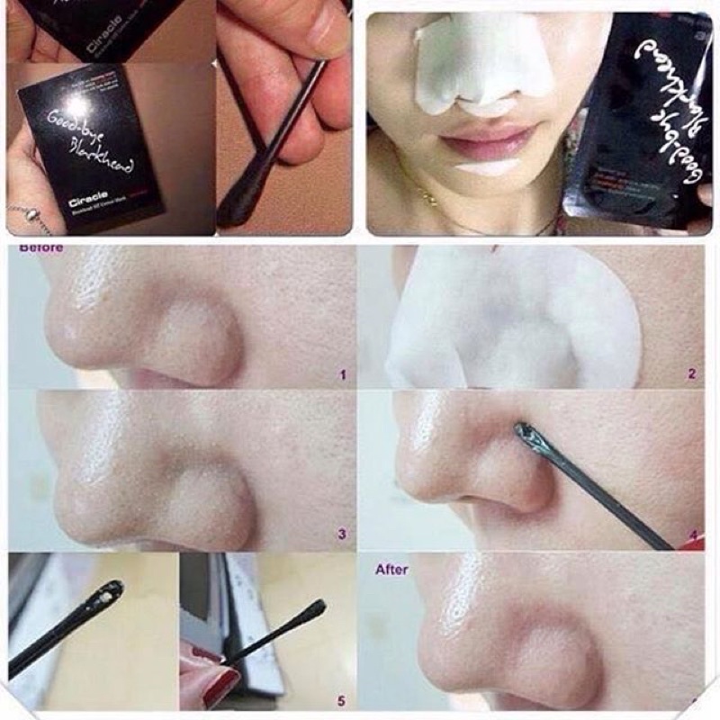 Miếng Đẩy Mụn Đầu Đen Ciracle Goodbye Blackhead