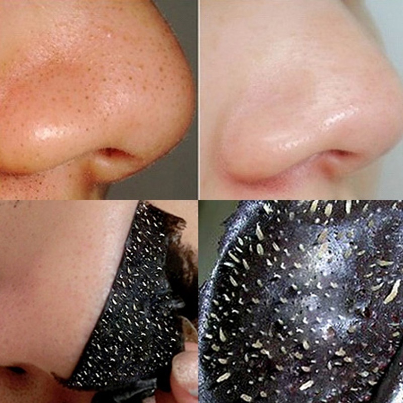 Mặt Nạ Lột Mụn Đầu Đen Làm Sạch Sâu Se Khít Lỗ Chân Lông