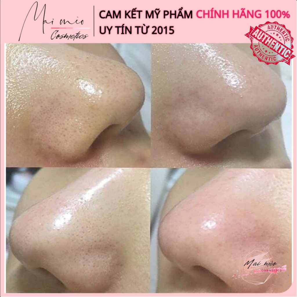 Ủ Mụn Medi-Peel Extra Super9- Mụn Cám Mụn Đầu Đen, Mụn Cám