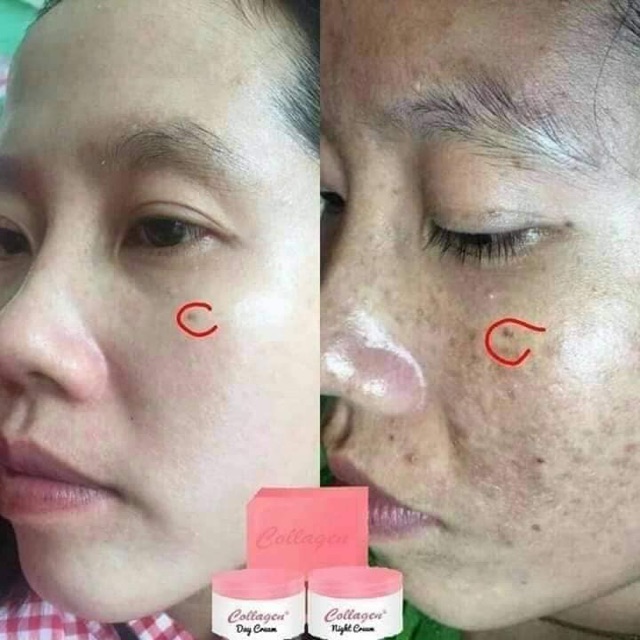 Collagen plus vit e giá chỉ 60.000₫