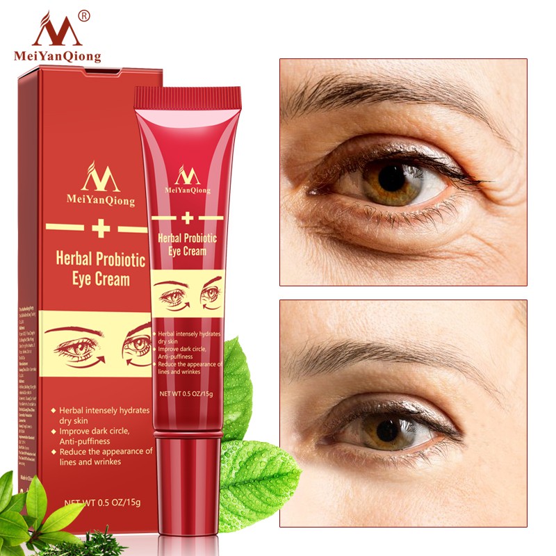 Kem dưỡng da mắt MeiYanQiong chống nếp nhăn xóa mờ quầng thâm dưỡng ẩm trắng da 15g | BigBuy360 - bigbuy360.vn