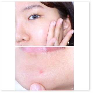 Tinh Chất Benton Snail Bee Ultimate Serum 35ml