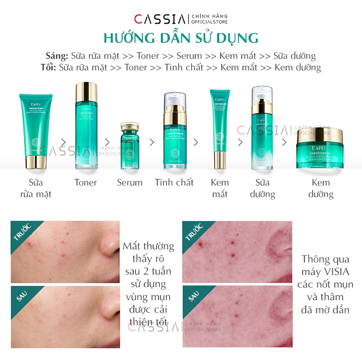 Bộ Chăm Sóc Da Mụn Kiềm Dầu Mờ Thâm Mụn, Bộ Dưỡng Da Sữa Rửa Mặt, Serum Kem Dưỡng Da Giúp Se Khít Lỗ Chân Lông Giảm Mụn