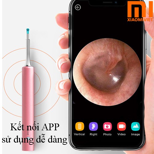 Dụng cụ lấy ráy tai có camera thông minh Bebird T5