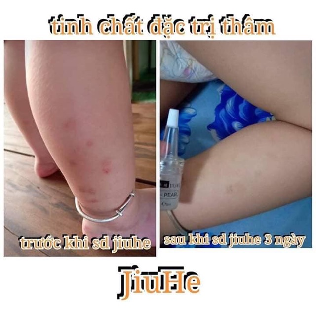 SERUM JIUHE PHIÊN BẢN MỚI 2020 | BigBuy360 - bigbuy360.vn