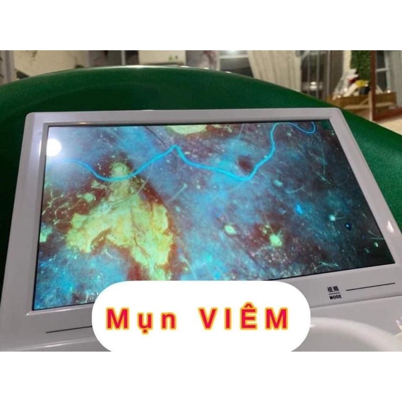 [ Freeship ]Máy soi da IPAD 11 inch- 3 chế độ soi- rõ nét- nhỏ gọn-tiện lợi