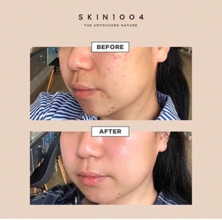 Tinh Chất Dưỡng Da Rau Má Skin