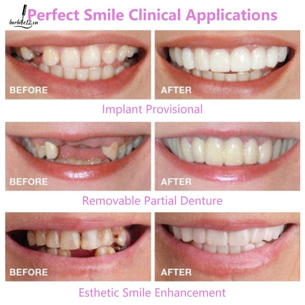 Upper And Lower Teeth Simulation Braces Five Generations Dentures Cover