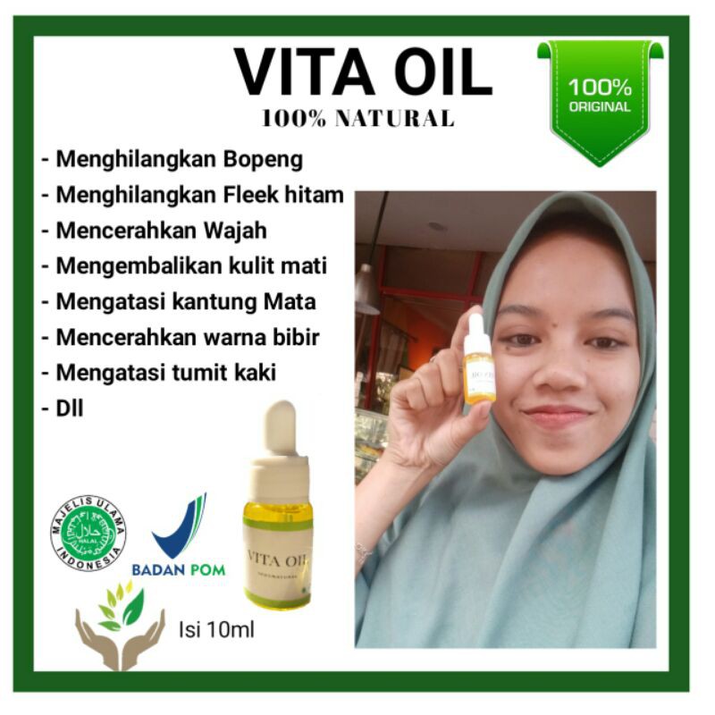 (hàng Mới Về) Kem Trị Sẹo Mụn Vitaoil Hiệu Quả