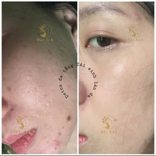Serum Detox Tái Tạo Da