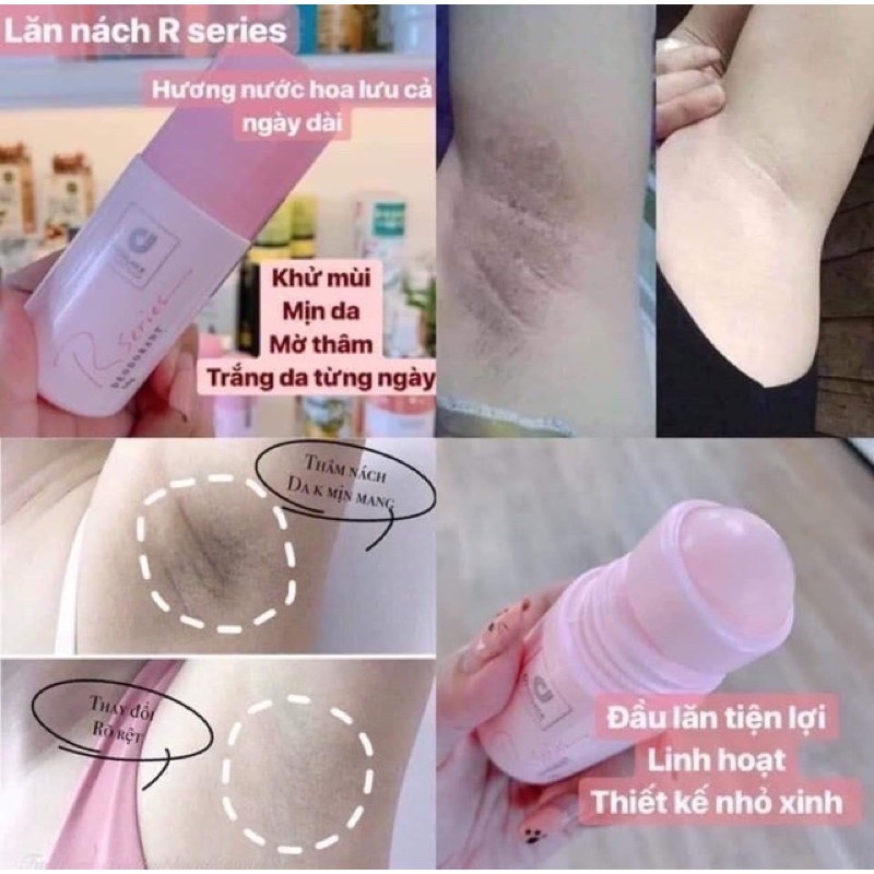 Lăn Nách Nước Hoa Giảm Thâm Rseries Thái Lan 🇹🇭