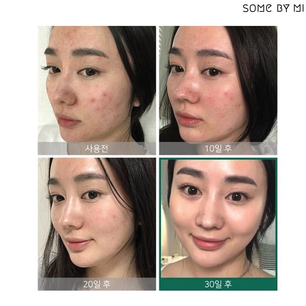 Nước Hoa Hồng Some By Mi AHA-BHA-PHA 30 Days Miracle Toner 30ml | BigBuy360 - bigbuy360.vn