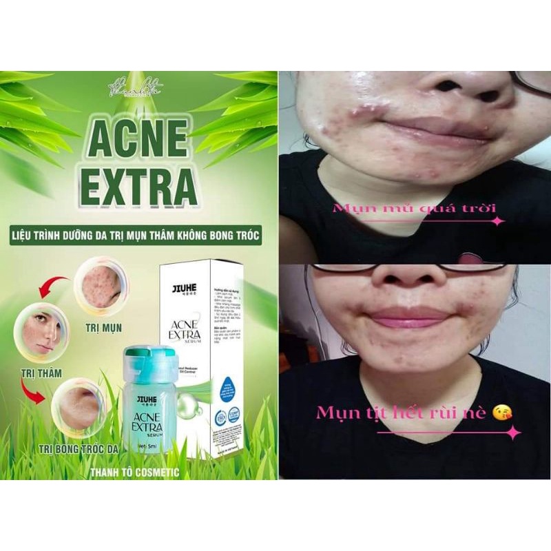 SERUM JIUHE Mụn Thanh Tô chính hãng