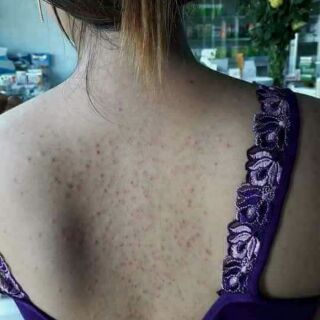 MUỐI TẮM TINH CHẤT SỮA NON L'ASENTA