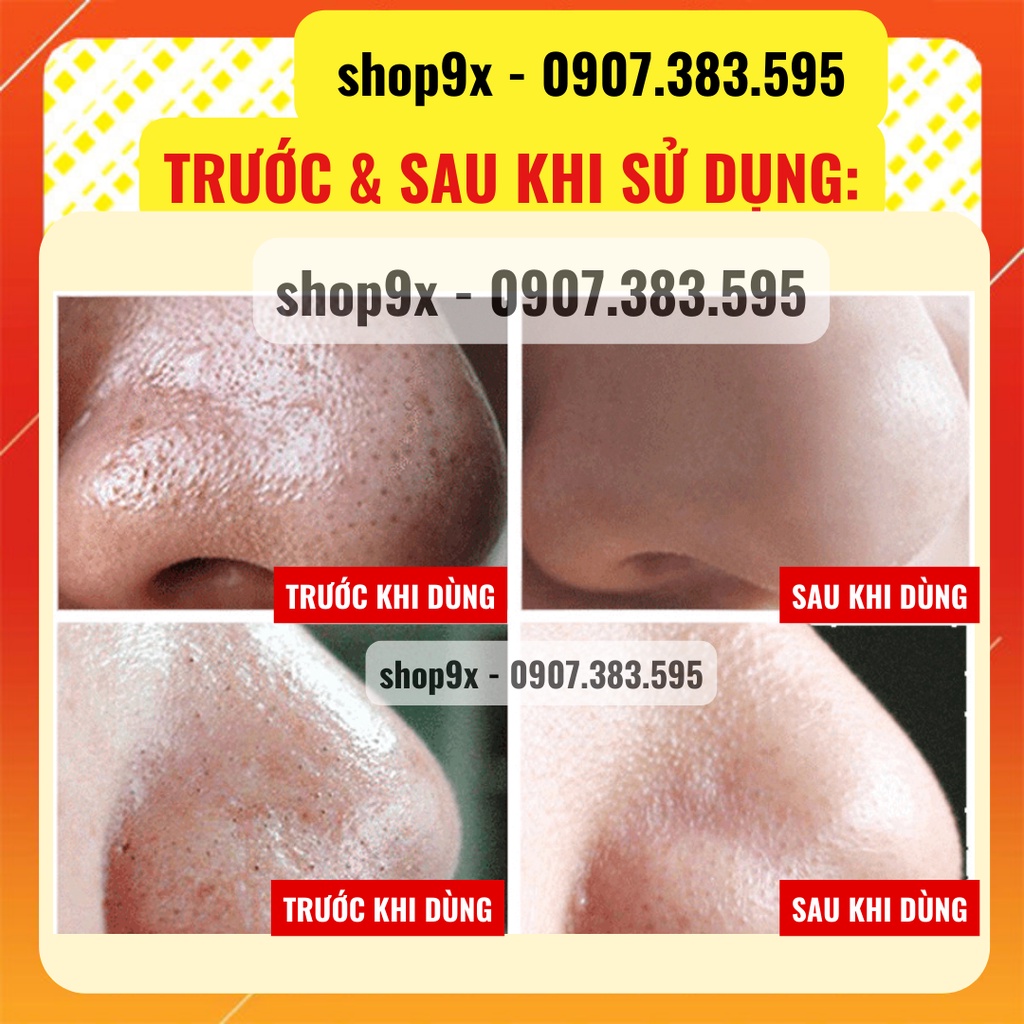 Mặt Nạ Hút Mụn Than Tre - Trắng Da Sạch Mụn