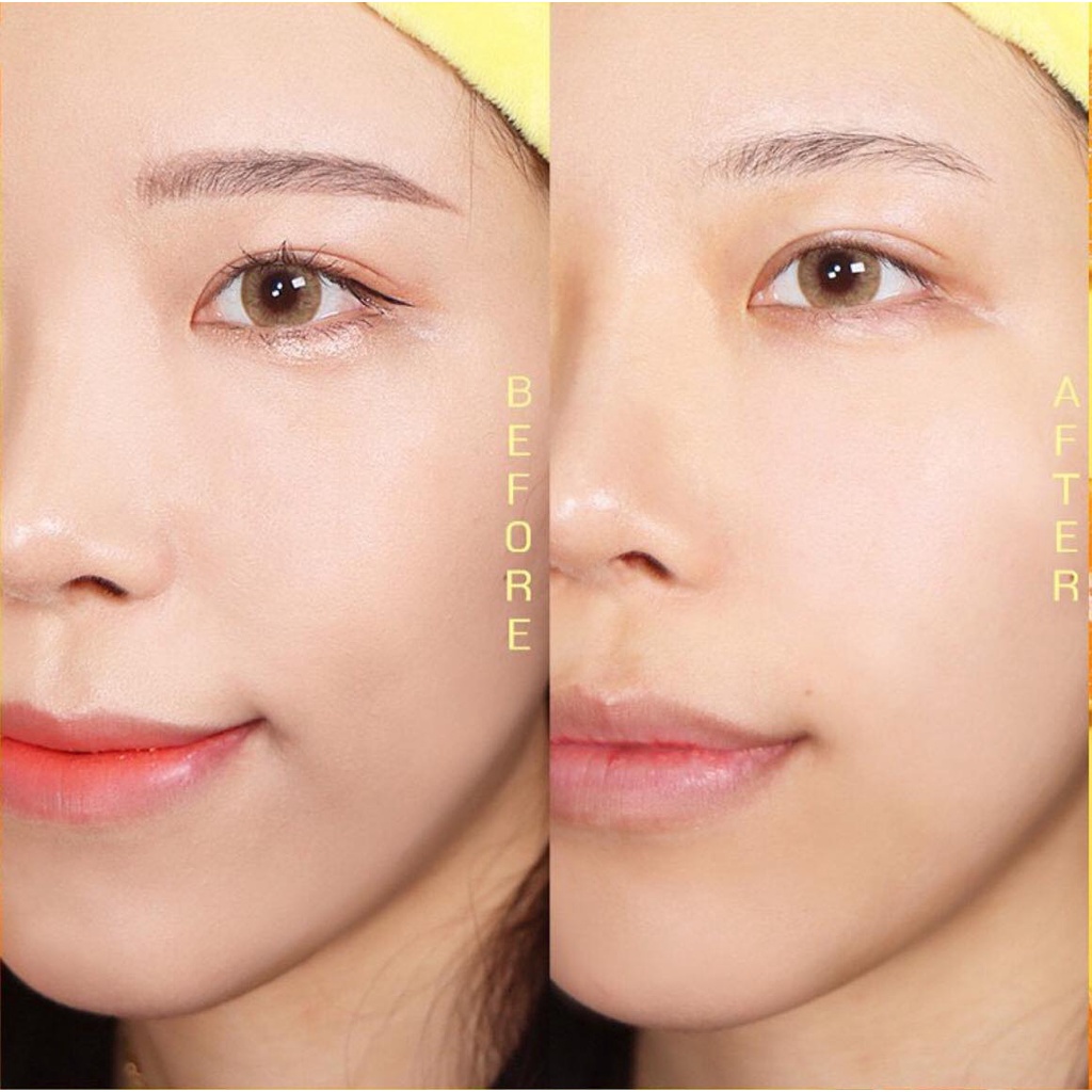 Q15_Dầu Tẩy Trang Peacholic Xoá Mụn Đầu Đen - Chăm Sóc Lỗ Chân Lông