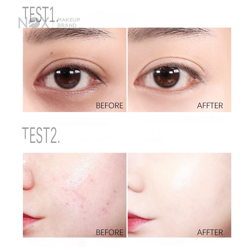 Kem che khuyết điểm NOX 3g dạng lì mịn màng lâu trôi tự nhiên ba màu che phủ toàn diện | BigBuy360 - bigbuy360.vn