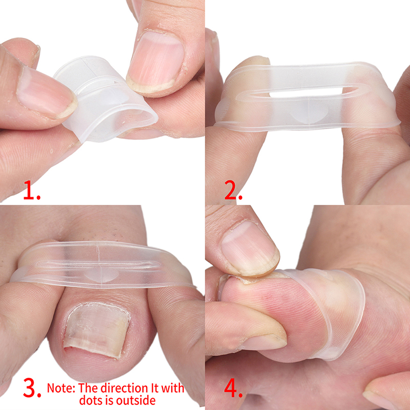 (Hàng Mới) Dụng Cụ Sửa Chữa Móng Tay Bằng Silicone