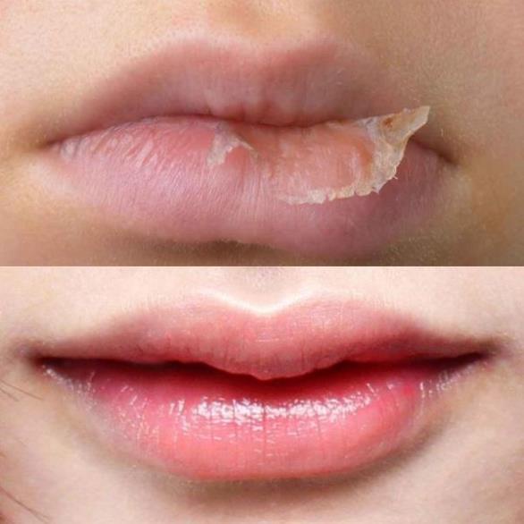 Sáp Dưỡng Hồng Môi Mềm Mịn Vaseline Rosy Lips 7G