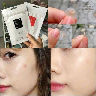 Miếng Dán Mụn Cosrx Master Patch
