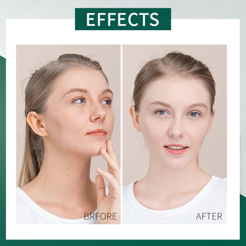 [Hàng mới về] Hộp 20 mặt nạ ngủ dạng thạch dưỡng ẩm kiềm dầu LAIKOU