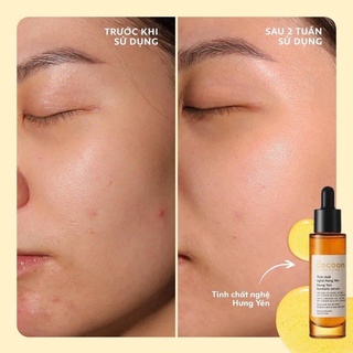 Tinh chất nghệ Hưng Yên Cocoon