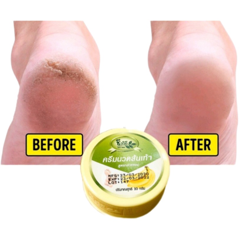 Chính hãng Thái - Kem dưỡng Giảm Nứt Gót Chân BANANA HEEL CREAM 30g Thái Lan - LQC18