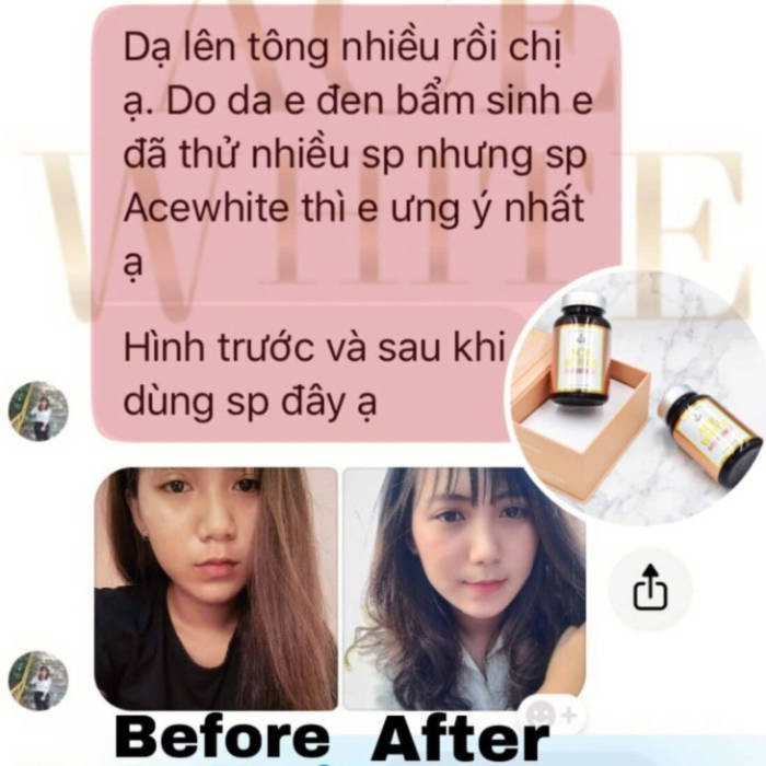 [COLLAGEN ĐẸP DA] Viên uống trắng da Collagen Ace White giúp giảm thâm, mờ nám, dưỡng trắng hồng hào, dưỡng trắng da mặt | BigBuy360 - bigbuy360.vn