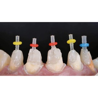 chốt sợi thủy tinh phục hình cùi răng