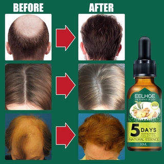 (Hàng Mới Về) Tinh Dầu Gừng Kích Thích Mọc Tóc Eelhoe 30ml